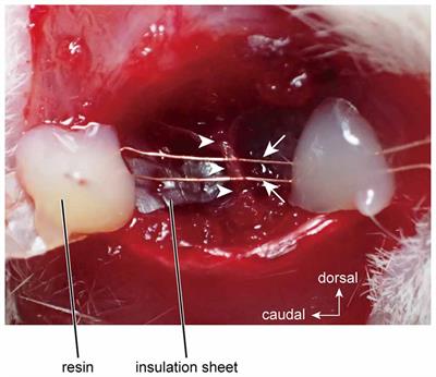 Spatiotemporal Profiles of Proprioception Processed by the Masseter Muscle Spindles in Rat Cerebral Cortex: An Optical Imaging Study